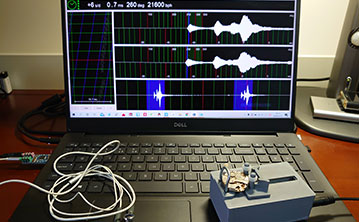 手表消磁(免费) 手表消磁(免费)
